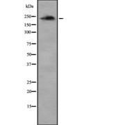 Western blot analysis of PIP5K using Jurkat whole cell lysates.