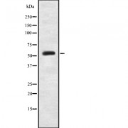 Western blot analysis of PKM2(phospho-Ser37) using HeLa whole cell lysates.