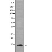 Western blot analysis of POLD4 using K562 whole cell lysates.
