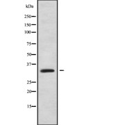 Western blot analysis of PPP1R3D using Jurkat whole cell lysates.
