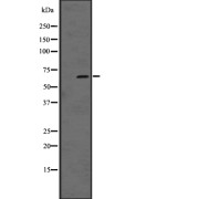 Western blot analysis of GPR37 expression in A431 whole cell lysate. The lane on the left is treated with the antigen-specific peptide.