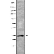 Western blot analysis of RAB28 using COLO205 whole cell lysates.