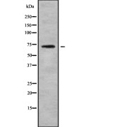 Western blot analysis of REPS2 using COLO205 whole cell lysates.