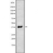Western blot analysis of RNF167 using MCF7 whole cell lysates.