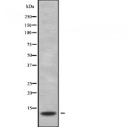 Western blot analysis of S100G using HeLa whole cell lysates.