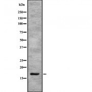 Western blot analysis of SEP15 using K562 whole cell lysates.