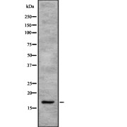 Western blot analysis of SEP15 using K562 whole cell lysates.