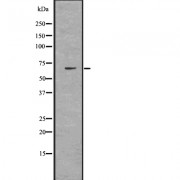Western blot analysis of FATP1 using HuvEc whole cell lysates.