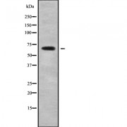 Western blot analysis of SLC6A13 using Jurkat whole cell lysates.