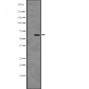 Western blot analysis of SQSTM1/p62 (Phospho-Ser403) using HepG2 whole cell lysates.