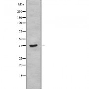 Western blot analysis of TAS2R38 using COLO205 whole cell lysates.
