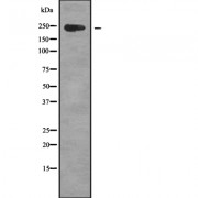 Western blot analysis of CCDC131 using Jurkat whole cell lysates.