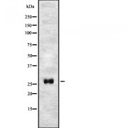 Western blot analysis of T106C expression in HEK293 cells. The lane on the left is treated with the antigen-specific peptide.