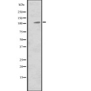 Western blot analysis of MIB2 expression in Hela cell lysate, The lane on the left is treated with the antigen-specific peptide.