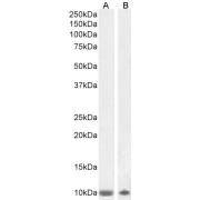 abx430001 (1 µg/ml) staining of Human Olfactory Bulb (A) and Cerebellum (B) lysates (35 µg protein in RIPA buffer). Primary incubation was 1 hour. Detected by chemiluminescence.