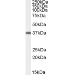 ARA9 Antibody