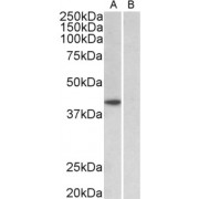abx430011 (1 µg/ml) staining of HeLa nuclear (A) and cytosolic (B) lysates (35 µg protein in RIPA buffer). Primary incubation was 1 hour. Detected by chemiluminescence.