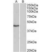 abx430012 (0.3 µg/ml) staining of HeLa nuclear (A) and cytosolic (B) lysates (35 µg protein in commercial extraction buffer). Primary incubation was 1 hour. Detected by chemiluminescence.