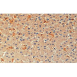 Target of Methylation-Induced Silencing 1 (TMS1) Antibody