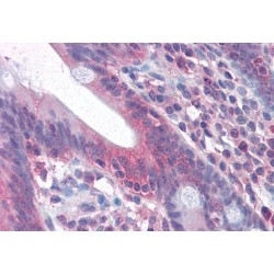 TNF Receptor Superfamily Member 6 / CD95 / TNFRSF6 (FAS) Antibody