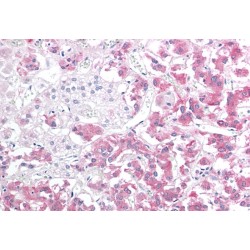 Small Stress Protein-Like Protein HSP22 (HSP22) Antibody