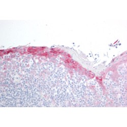 Small Stress Protein-Like Protein HSP22 (HSP22) Antibody