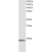 abx430030 staining (1 µg/ml) of Human Muscle lysate (RIPA buffer, 30 µg total protein per lane). Detected by chemiluminescence.