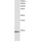 Small Stress Protein-Like Protein HSP22 (HSP22) Antibody
