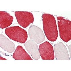 Melanoma Inhibitory Activity (MIA) Antibody