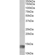 abx430034 (1 µg/ml) staining of Human Glioma lysate (35 µg protein in RIPA buffer). Detected by chemiluminescence.