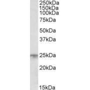 abx430036 (1 µg/ml) staining of Human Bone Marrow lysate (35 µg protein in RIPA buffer). Primary incubation was 1 hour. Detected by chemiluminescence.