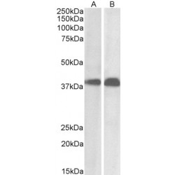 Protein SET (SET) Antibody