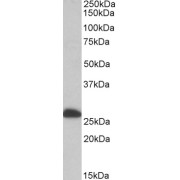 abx430045 (0.1 µg/ml) staining of Human Liver lysate (35 µg protein in RIPA buffer). Primary incubation was 1 hour. Detected by chemiluminescence.