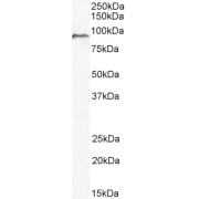 abx430049
