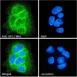 Allograft Inflammatory Factor 1 Isoform 3 (AIF1 Isoform 3) Antibody