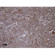 abx430050