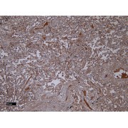 IHC-P analysis of paraffin embedded Human Lung tissue using IBA1 antibody (6 µg/ml).