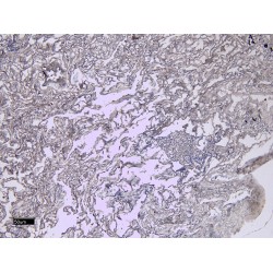 Allograft Inflammatory Factor 1 Isoform 3 (AIF1 Isoform 3) Antibody