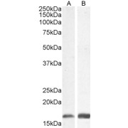 Western blot analysis of Human lymph node and Mouse brain lysates (35 µg protein in RIPA buffer) using Allograft Inflammatory Factor 1 Antibody (1 µg/ml).