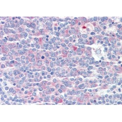 Chaperonin Containing TCP1, Subunit 3 (CCT3) Antibody