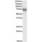 Tripeptidyl-Peptidase 1 (CLN2) Antibody