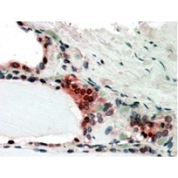 COP9 Signalosome Subunit 2 (COPS2) Antibody