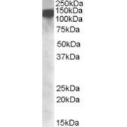 Western blot analysis of HeLa nuclear lysate (35 µg protein in RIPA buffer) using DEAD/H (Asp-Glu-Ala-Asp/His) Box Polypeptide 9 (DHX9) Antibody (1 µg/ml, 1 hour).