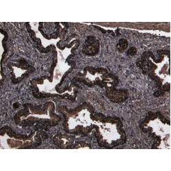 Dipeptidyl Peptidase 4 / CD26 (DPP4) Antibody