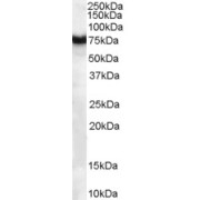 abx430074 (1 µg/ml) staining of Human Pancreas lysate (35 µg protein in RIPA buffer). Detected by chemiluminescence.