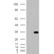 HEK293 overexpressing HADH with C-terminal tag (DYKDDDDK) and probed with anti-DYKDDDDK in the left panel and with abx430078 in the right panel (mock transfection in first and last lanes).