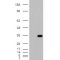 Hydroxyacyl-Coenzyme A Dehydrogenase, Mitochondrial (HADHSC) Antibody