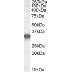 Hydroxyacyl-Coenzyme A Dehydrogenase, Mitochondrial (HADHSC) Antibody