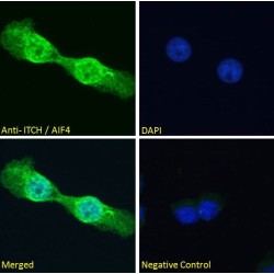 Itchy E3 Ubiquitin Protein Ligase (ITCH) Antibody