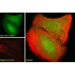 Itchy E3 Ubiquitin Protein Ligase (ITCH) Antibody